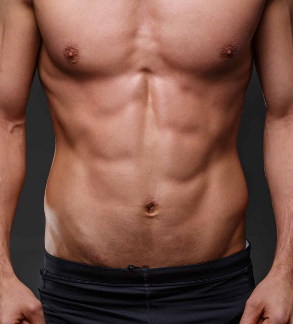 Gynecomastia Consultation Image